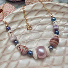 EDISON PUKA & CONE KESHI NECKLACE 18" GF (N10)